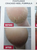 Footlogix Cracked Heel Formula